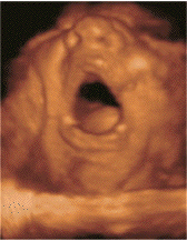 fetal yawn