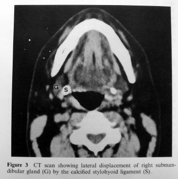 stylohyoid