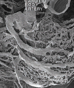 carotid body