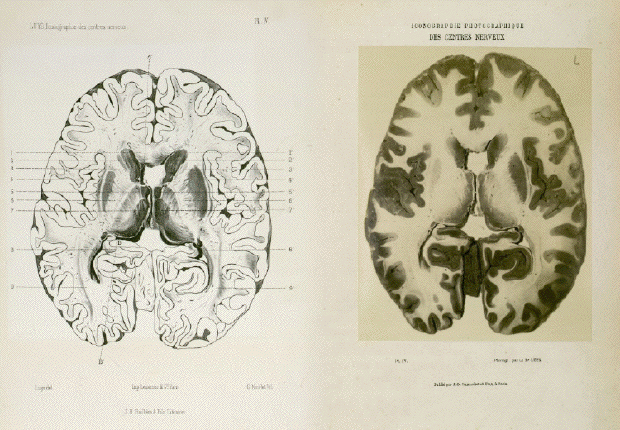 atlas de luys