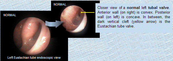 eustcahe