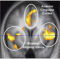 insula