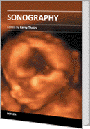 sonography