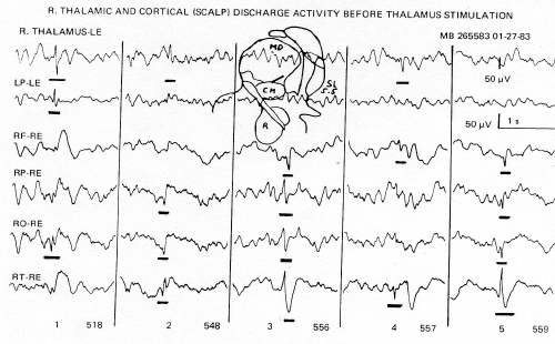 eeg