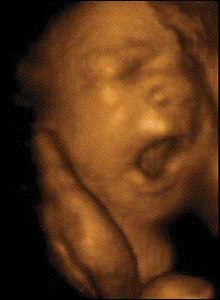 fetal yawn