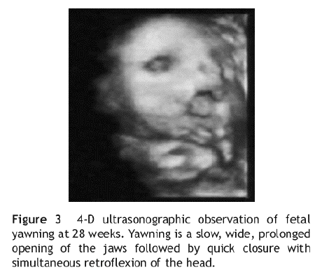 fetal yawning