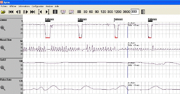 holter-apios