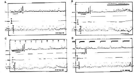 askenazy-graph