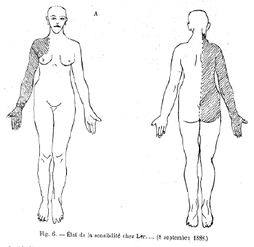 schéma-sensibilité