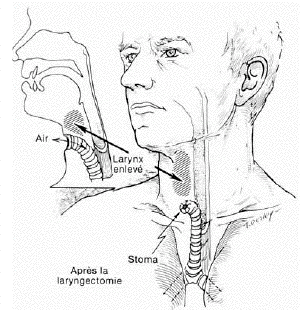 larynx