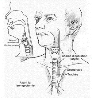 larynx