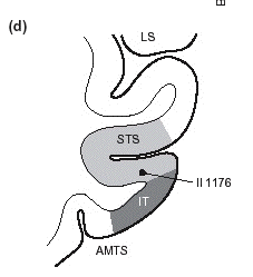 sts